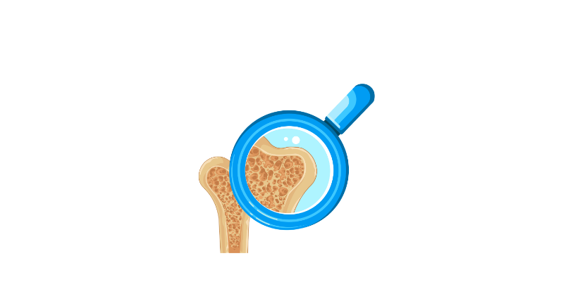 Bone mineral density